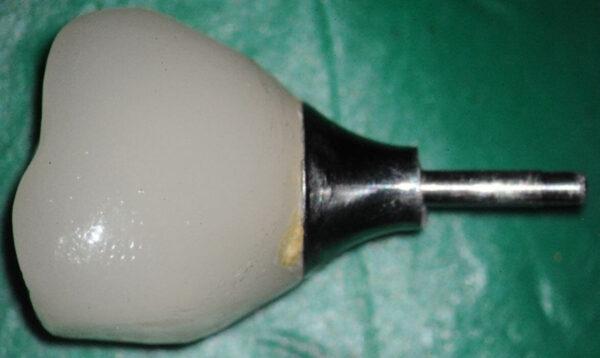 Extra oral of crown and screw shaft w/o thread basket