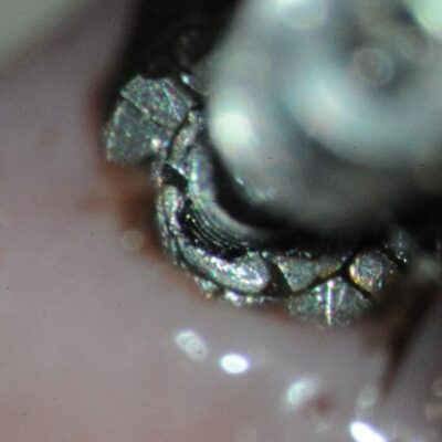 Minor loss of threads on left