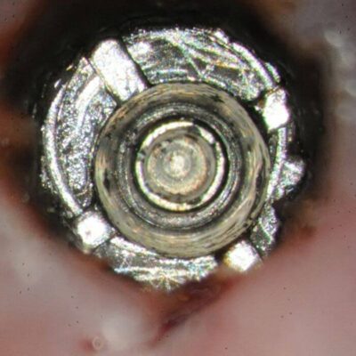 Conus clear with thread basket still in place – a focus stacked image