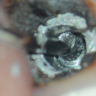 Ankylos fractured Zirconia Abutment-3 In fracturing of zirconia wall with a root tip pick