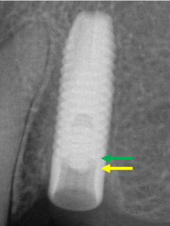 Case Study 44 image (1)