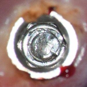 #27 Preop clinical at 25x