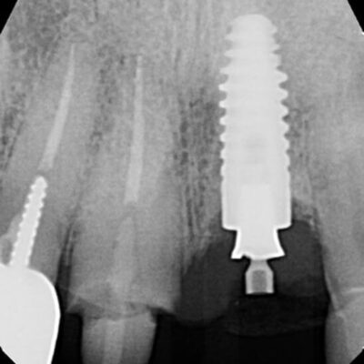 PA image from Dr. S.