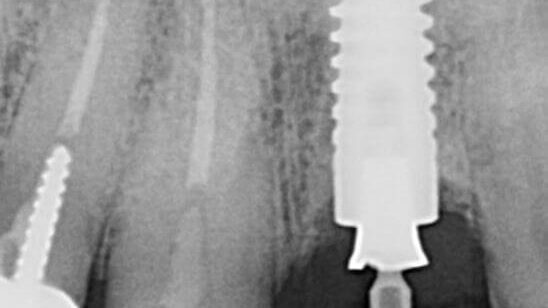 PA image from Dr. S.