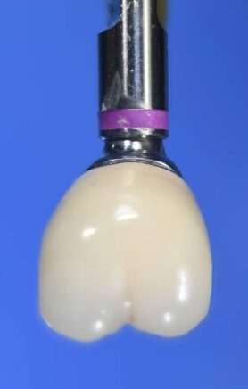 Facial view