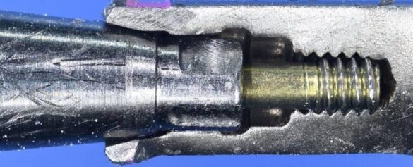 IMR Case Study Wrong Restorative Component Picture2 (6)