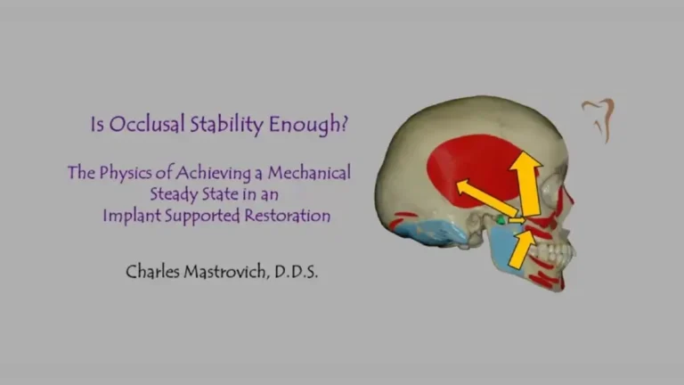 Mastrovich-Dental-Implant-Occlusion-and-Occlusal-Schemes
