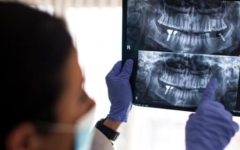 Broken Implant Pre-appointment Preparation Mastrovich Dental