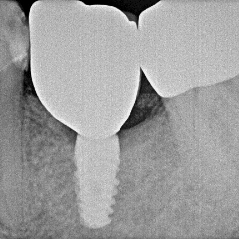 Neogent_Preop_image Neogent_Preop_image