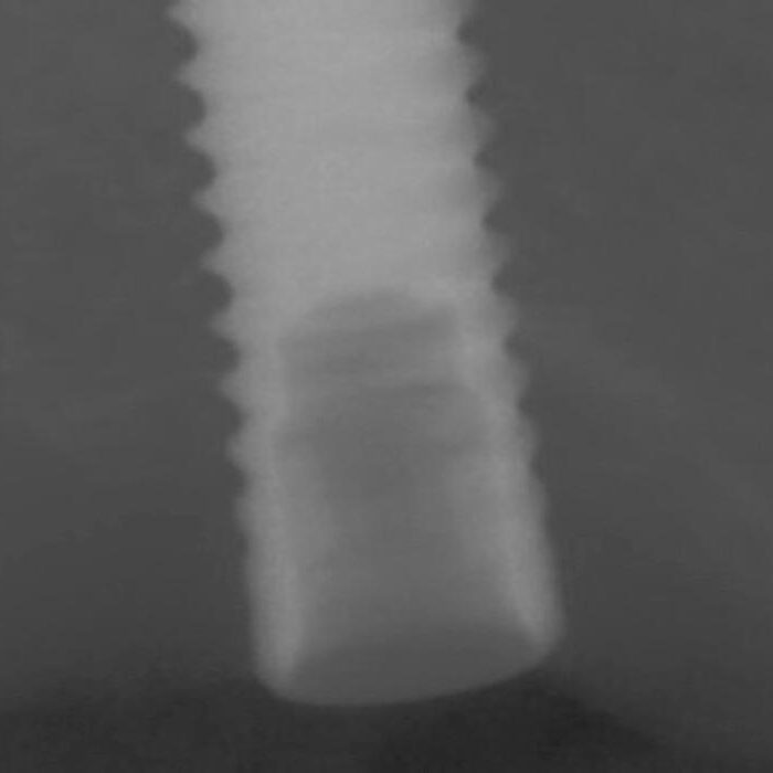 Preop images from Dr. S. office Preop images from Dr. S. office