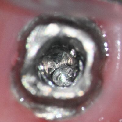 Concentric bore to depth, photo is slightly angled to visualize depth.