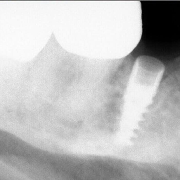 Preop radiographs from Dr. S. Preop radiographs from Dr. S.