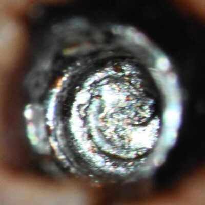 Retrieval_of_a_fractured_Straumann_Healing_Abutment_Post_Ultrasonic_Attempt_Preop_clinical_2 Preop clinical at 25x magnifacation. Note the smeared appearance of the fragment-implant junction. This is secondary to ultrasonic