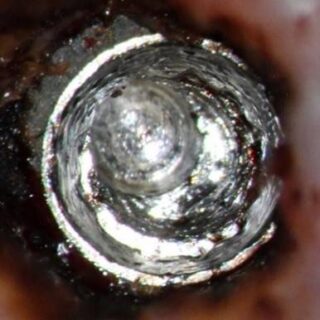 Salvin screw recovery kit - Groat Case 0034 (7)