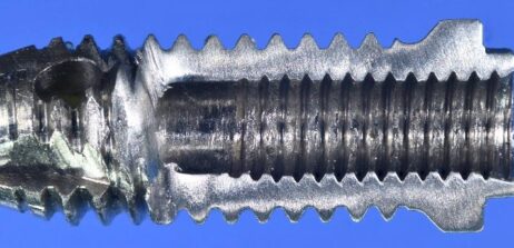 Open old Nobel external hex RP implant with the internal threading to the top of  implant