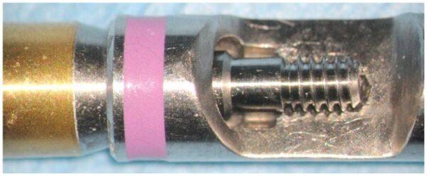 Ultrasonic thread damage Bufty Case 0033 (17)