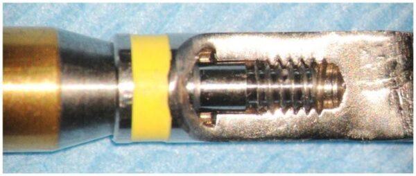 Ultrasonic thread damage Bufty Case 0033 (18)