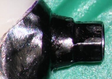 mastrovich-dental_case-study-gb-003 mastrovich-dental_case-study-gb-003