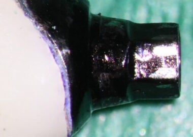 mastrovich-dental_case-study-gb-004 mastrovich-dental_case-study-gb-004