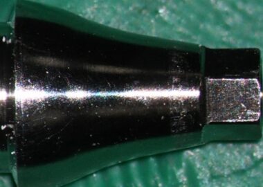 mastrovich-dental_case-study-gb-005 New temporary abutment