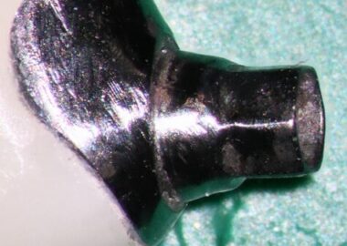 mastrovich-dental_case-study-gb-006 Crown and abutment view 2