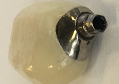 mastrovich-dental_case-study-gb-009 Original photo from Dr. Z