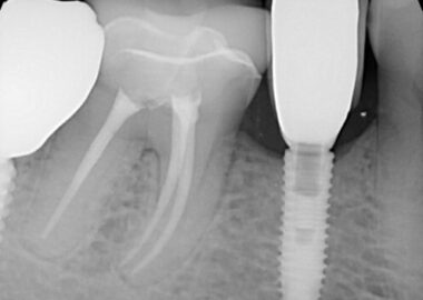 mastrovich-dental_case-study-gb-014 Preop images from Dr. Z.