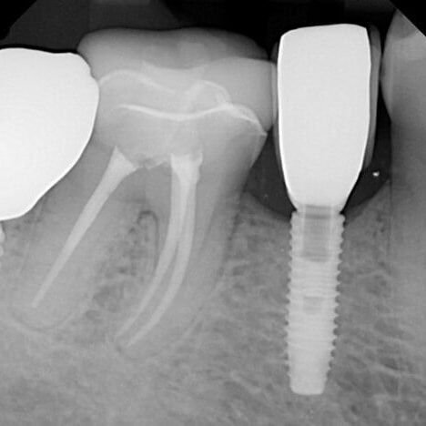 mastrovich-dental_case-study-gb-014 Preop images from Dr. Z.