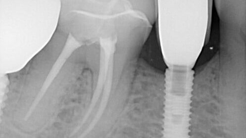 Preop images from Dr. Z.