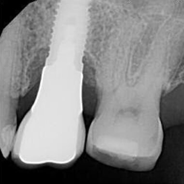 mastrovich-dental_case-study-sg-9 Preop. image from Dr. K