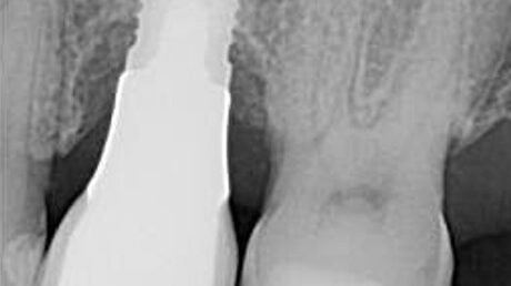 Preop. image from Dr. K