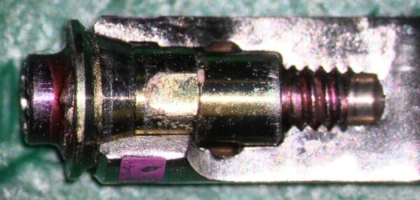 mastrovich-dental_case-study-tibase-aubtment-005 Recovered abutment fragment on an open RC BL analog