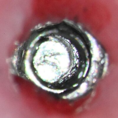 Abutment tapped to M1.8