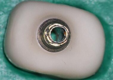 mastrovich-dental_case-study-wa-1