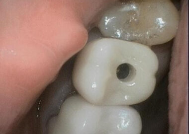 image supplied preoperatively