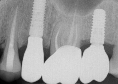 image supplied preoperatively