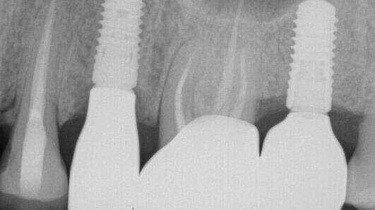 image supplied preoperatively