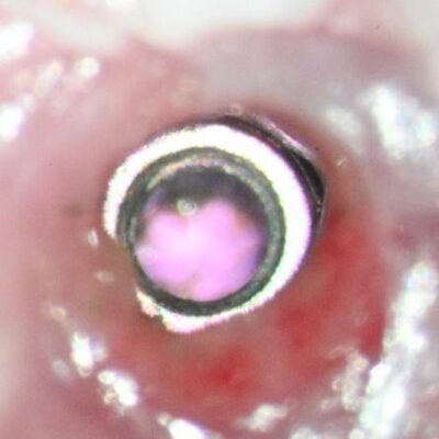 post op clinical 25x post op clinical 25x