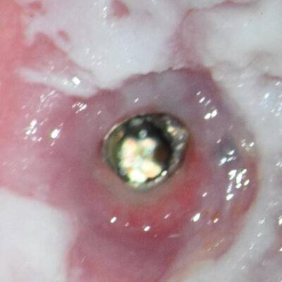 preop clinical 25x preop clinical 25x